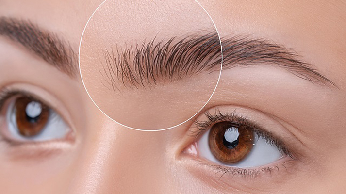 Carbon-Facial-in-Noida